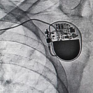 Corporate Access: Cardiac Devices in Practice